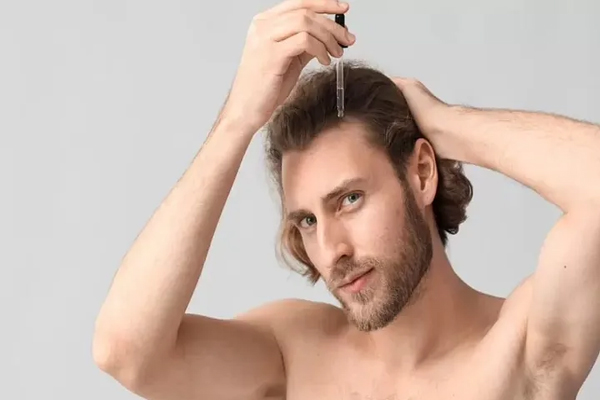 Por qué se nos cae mucho el pelo - Hombre aplicando gotas de minoxidil en el cuero cabelludo, para estimular el crecimiento capilar en las zonas afectadas por la pérdida de cabello