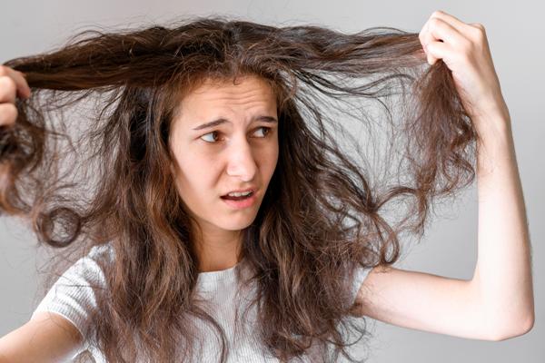 Hidratación del pelo - Mujer abrumada por tener un cabello seco, quebradizo y con frizz, como consecuencia de no hidratar correctamente el pelo