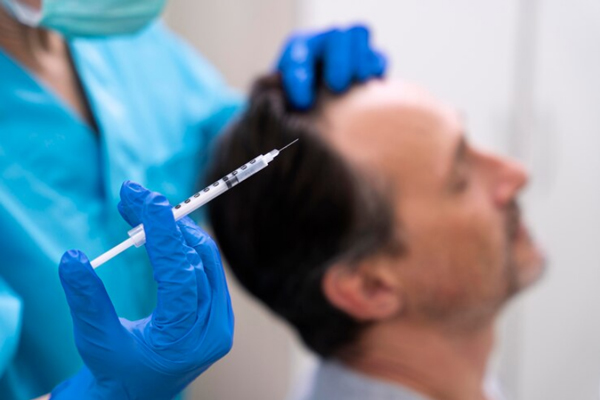 Anestesia en el injerto capilar - Médico capilar sosteniendo en su mano una inyectadora para aplicar la anestesia en el implante de cabello a un hombre y evitar el dolor
