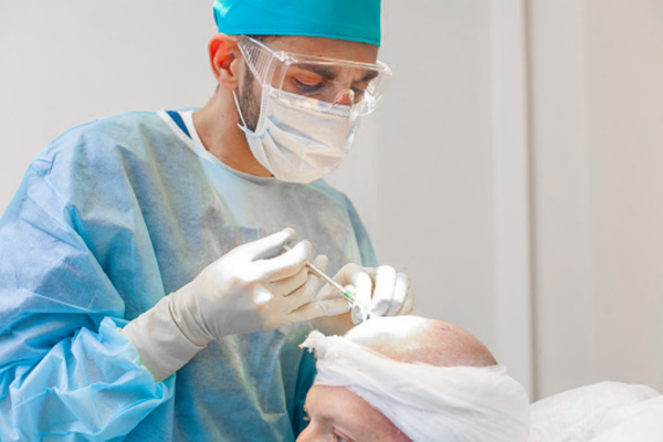 Anestesia en el injerto capilar - Tricólogo aplicando la anestesia en la cabeza de un hombre antes de realizar el tratamiento de implante de cabello