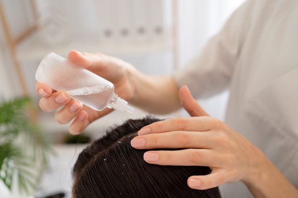 Beneficios del vinagre para el cabello - Estilista utiliza una solución con propiedades antifúngicas y antibacterianas para optimizar la limpieza del cuero cabelludo en una cliente con caspa