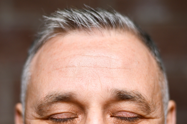 Canas - Hombre de escasa densidad capilar y con entradas en la sien cierra los ojos mientras se somete a una evaluación exhaustiva en manos de un tricólogo 