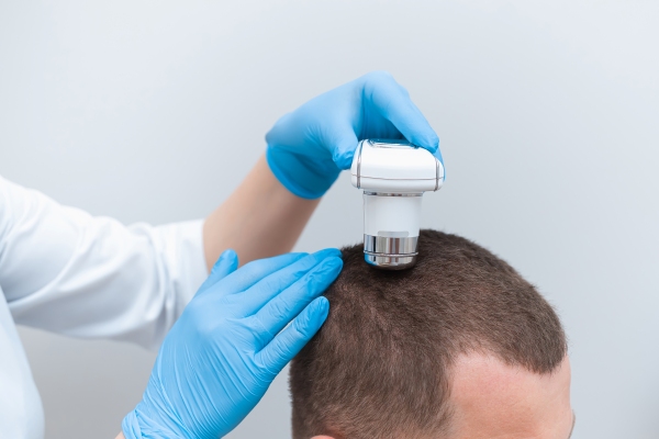 Dermatólogo utiliza un tricoscopio para diagnosticar con mayor precisión los problemas que comprometen la salud capilar de un paciente