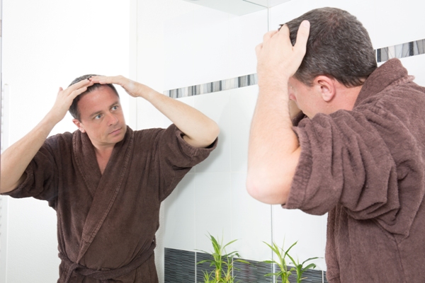 Calvicie y el cabello graso - Hombre observando en el espejo que comienza a perder cabello de manera acelerada, ocasionando zonas del cuero cabelludo con calvicie