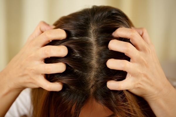 mujer rascándose con vehemencia su cabello