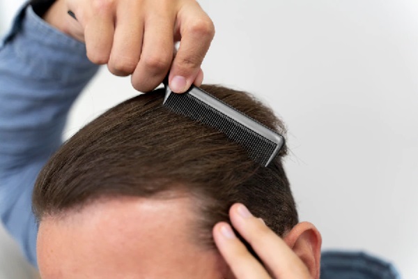 Cuidar el pelo en los hombres - Hombre peinando su cabello de manera suave, para no dañar los folículos pilosos