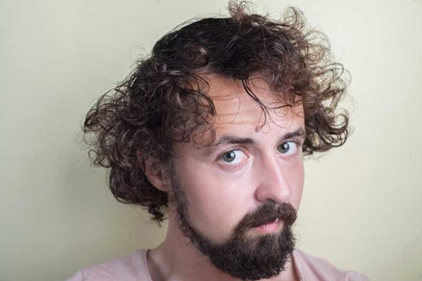 Fumar aumenta la caída del pelo - hombre con el cabello largo con el que tapa los problemas de alopecia en las sienes