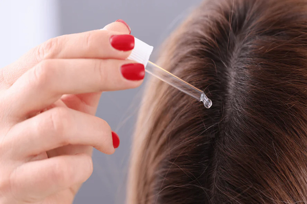 mujer usando minoxidil en forma tópica para recuperar su cabello