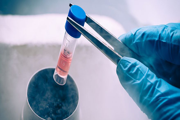 células madres - técnico de laboratorio sacando un vial cerrado de un entorno de temperatura bajo cero