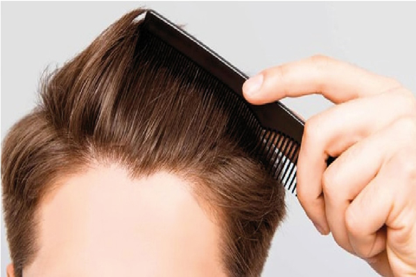 células madres - hombre peinándose el cabello