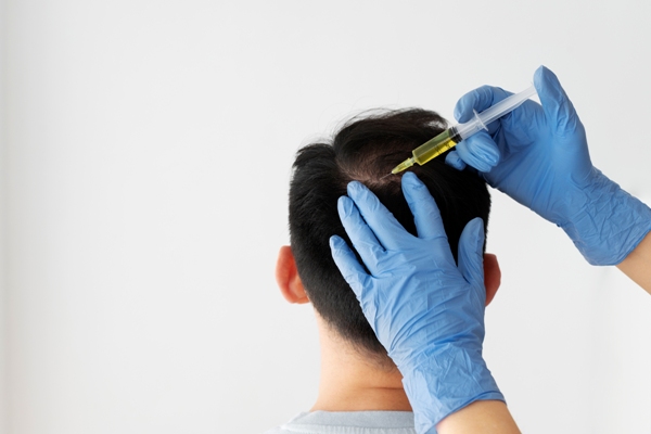 Mesoterapia capilar - hombre en la consulta de la especialista la cual sostiene una inyección para realizar el tratamiento de mesoterapia capilar