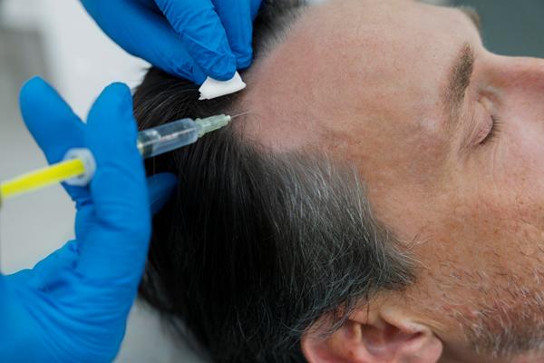 hombre en la consulta de la especialista la cual sostiene una inyección para realizar el tratamiento en la zona de la sien