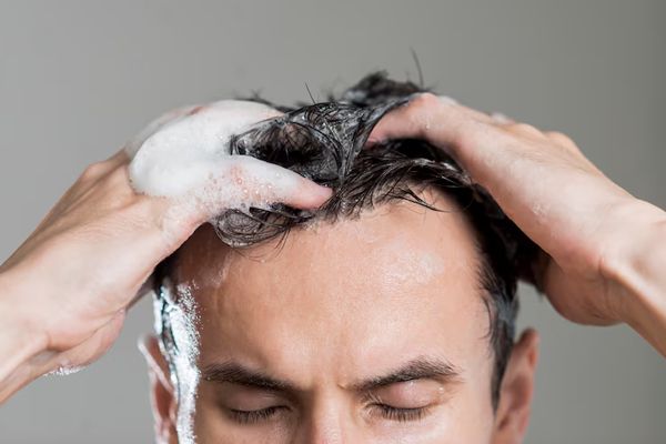 Biotina - Hombre emplea champú estimulante sobre el cuero cabelludo para contrarrestar la caída del cabello