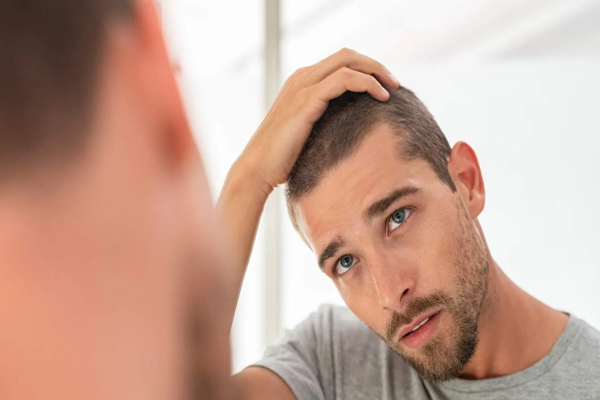 Champús para estimular el crecimiento del cabello - Hombre se mira frente al espejo preocupado por el estado de sus pelo