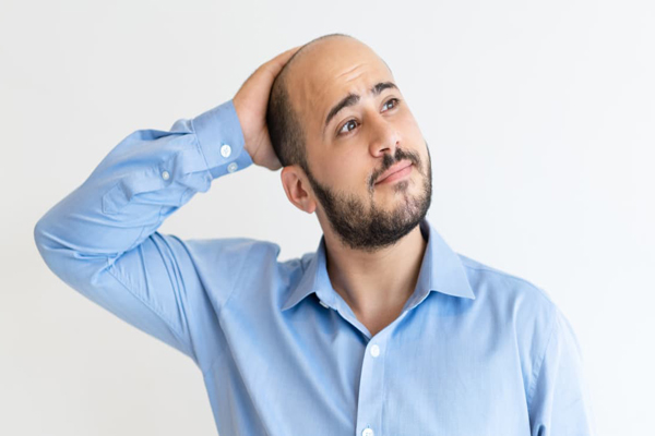 Zona donante - Hombre con alopecia se toca la cabeza con preocupación tras analizar las opciones que tiene para recuperar la abundancia de su cabello