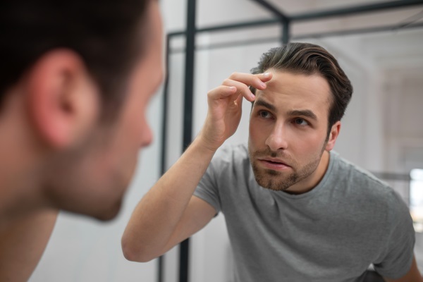 Testosterona y caída del cabello - Hombre observando en el espejo que está presentando pérdida de cabello en las entradas