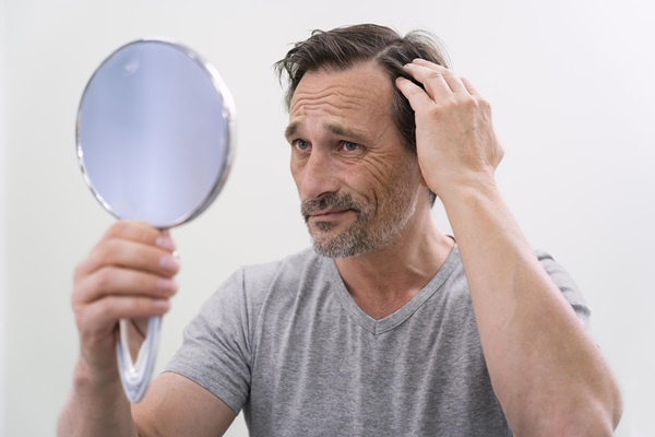 Testosterona y caída del cabello - Hombre observando en el espejo que presenta alopecia androgénica, por el aumento de los niveles de dihidrotestosterona