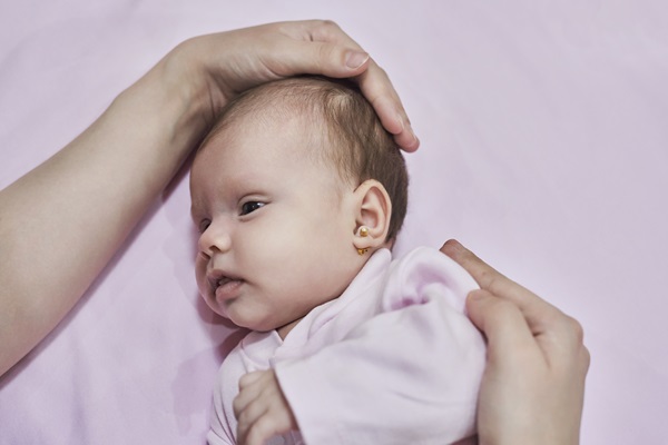 Hemangioma capilar - Bebé recién nacido presenta los síntomas de un hemangioma capilar en el cuero cabelludo