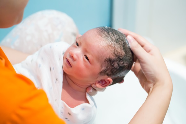 Hemangioma capilar - Madre bañando a su bebé recién nacido con mucha precaución, para no irritar el hemangioma capilar superficial que presenta en la cabeza