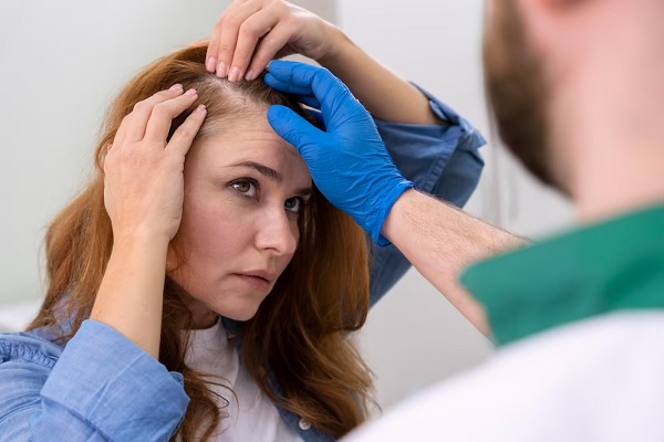 Tricofagia - Cirujano capilar evalúa el estado del cuero cabelludo de una paciente con problemas de alopecia 