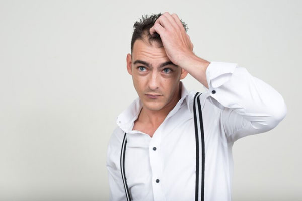 Alopecia juvenil - Hombre de ojos azules con visibles claros en la parte frontal de la cabeza se muestra preocupado por salud capilar