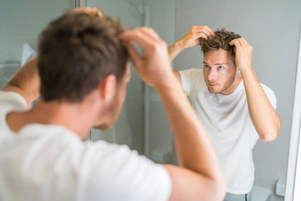 Alopecia juvenil - Joven de cabello castaño se mira constata pérdida de densidad capilar al mirarse frente al espejo