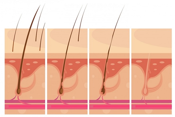 fases del crecimiento del pelo - Ilustración de cómo crece el cabello de una persona a lo largo de la vida