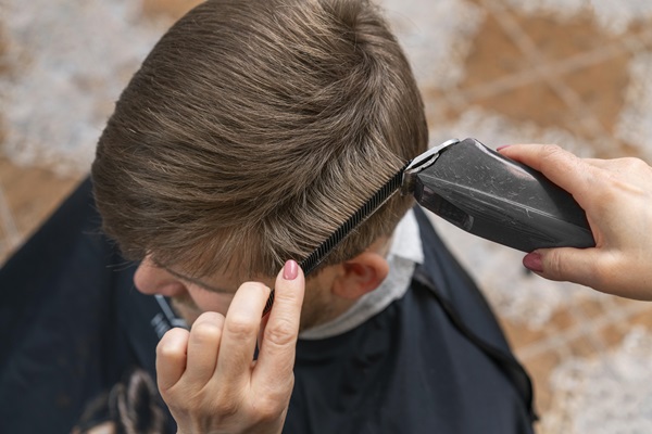 Pelo tras injerto capilar - Barbero cortando el cabello de un hombre con máquina luego de 5 meses del injerto capilar