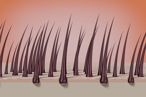Imagen del crecimiento del cabello cuando se encuentra en la fase catágena