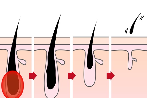 Caída del cabello por Covid - Imagen de las diferentes fases del crecimiento del cabello, desde su nacimiento hasta la caída de la hebra capilar