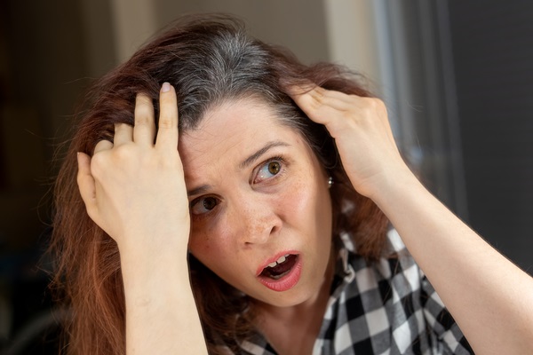 Alopecia androgénica en mujeres - Mujer sorprendida por las zonas calvas que comienza a ver en el cuero cabelludo, debido al avance de la alopecia androgénica