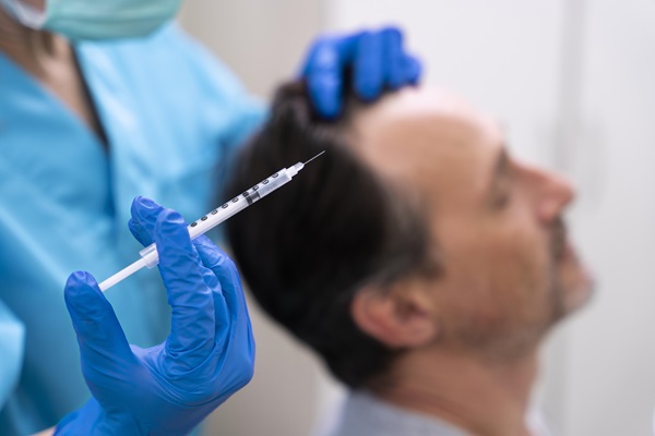 Caída del cabello por Covid - Médico especialista realizando un tratamiento capilar a un paciente masculino, para estimular el crecimiento capilar