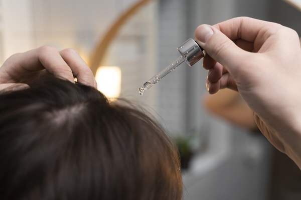 Mujer aplicándose un tratamiento médico en el cabello, para estimular el crecimiento capilar