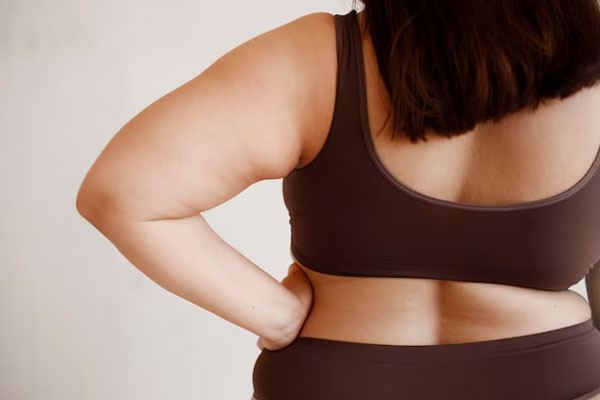 Hirsutismo hormonal - Mujer con sobrepeso posa de espalda en ropa interior elástica