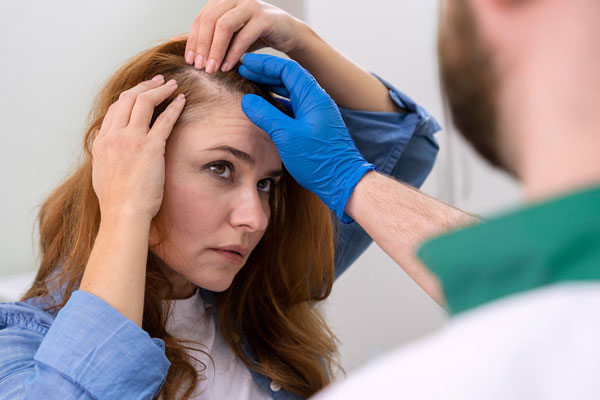 Alopecia en la menopausia - Tricólogo examina con detenimiento el cuero cabelludo de una paciente con entradas y efluvio telógeno