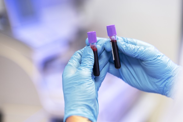 Médico sostiene dos tubos de ensayo con muestras de análisis de sangre