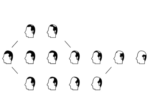 Grados de alopecia - dibujo con el esquema del avance de la alopecia