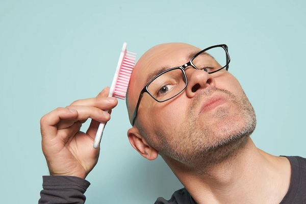Grados de alopecia - hombre calvo con gafas pasando un cepillo por su cabeza completamente calva