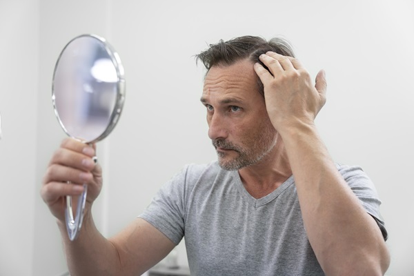 Hombre usa un espejo para observar el avance de la pérdida de cabello