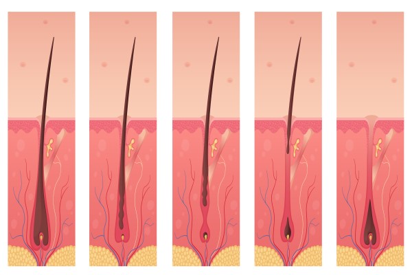 genes causantes de la alopecia - fases del crecimiento del cabello