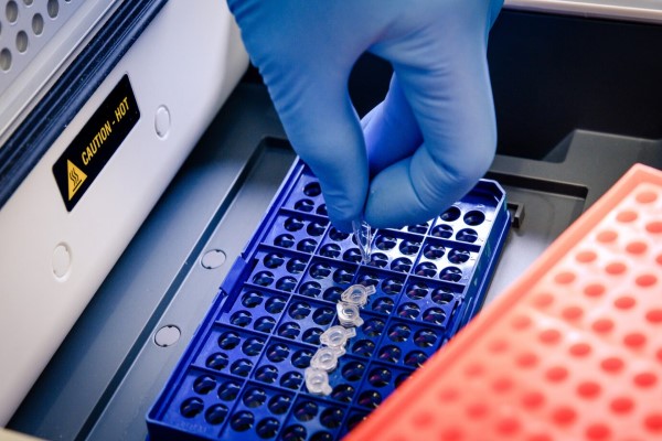 técnico de laboratorio colocando muestras en pipetas para un análisis genético