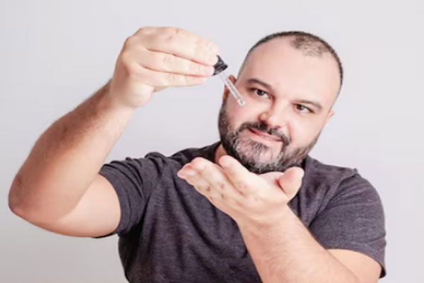 Hombre calvo recurre a un tratamiento tópico con Minoxidil para desacelerar la alopecia y estimular el crecimiento del cabello