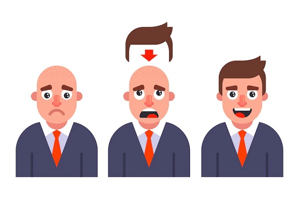 Sistema de integración capilar - Representación gráfica del estado de ánimo de un hombre calvo antes y después de usar una peluca