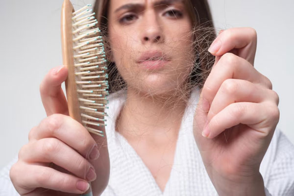 Desenredar el pelo - Joven con pérdida de cabello extrae varios mechones de pelo de un cepillo 