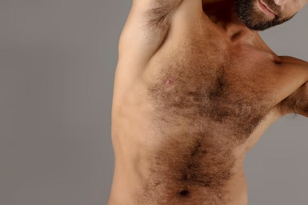 Trasplante de pelo corporal 2 - Hombre con mucho vello en el cuerpo y la barba, ideales para un injerto de vello corporal