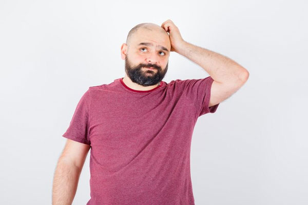 Hombre con alopecia busca tratamientos capilares efectivos para recuperar el cabello