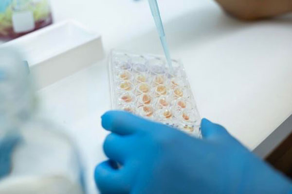Clonación capilar - Científico trabaja en un cultivo celular para contribuir con el desarrollo de tratamientos para la calvicie 