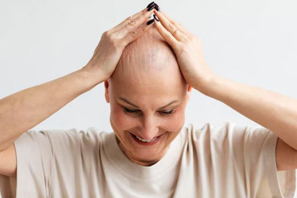 Clonación capilar - Mujer con alopecia cicatricial sonríe ante los avances de la medicina capilar 