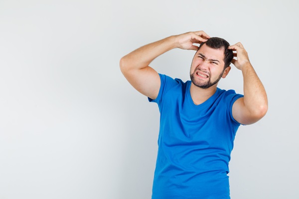 Picores por Minoxidil - Hombre joven con alopecia rascando su cabeza para aliviar la picazón del cuero cabelludo