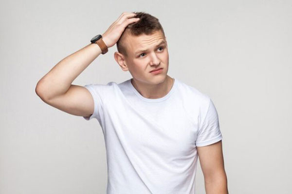Alopecia prematura - Joven con síntomas de calvicie temprana busca tratamientos capilares para regenerar el cabello